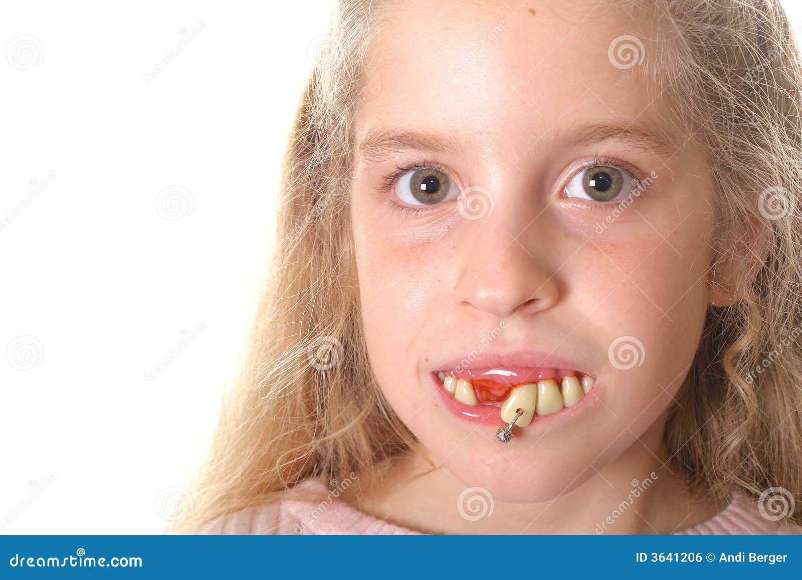 Pretty Little Girl With Ugly Teeth (copy Space Left) Stock 