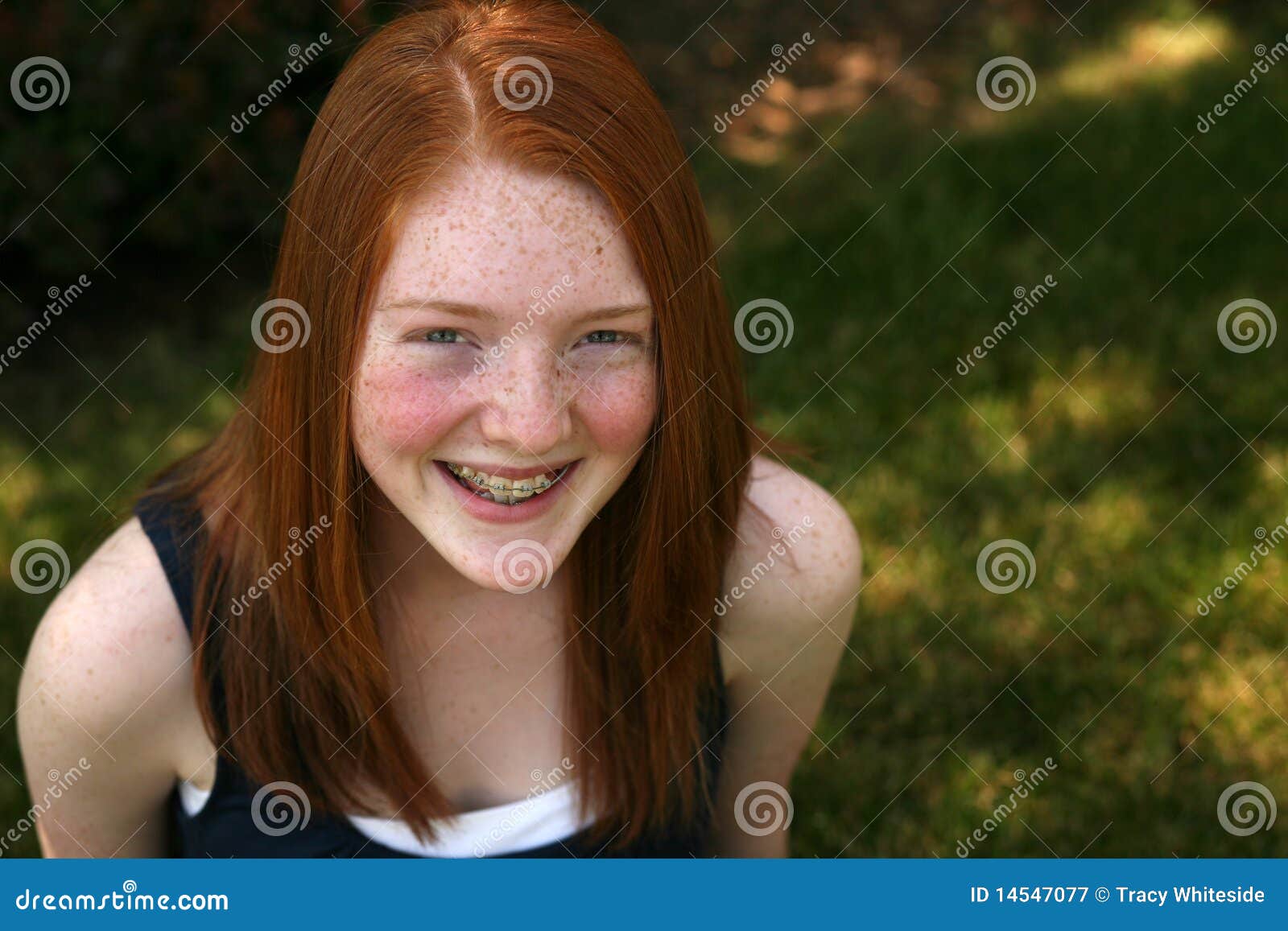 redhead girls with braces