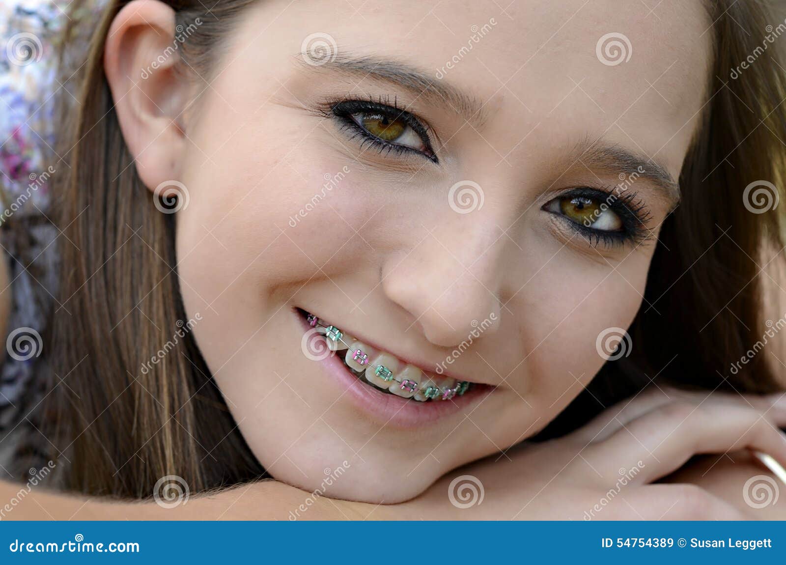 Pretty Teen With Braces Stock Image Image Of Chee