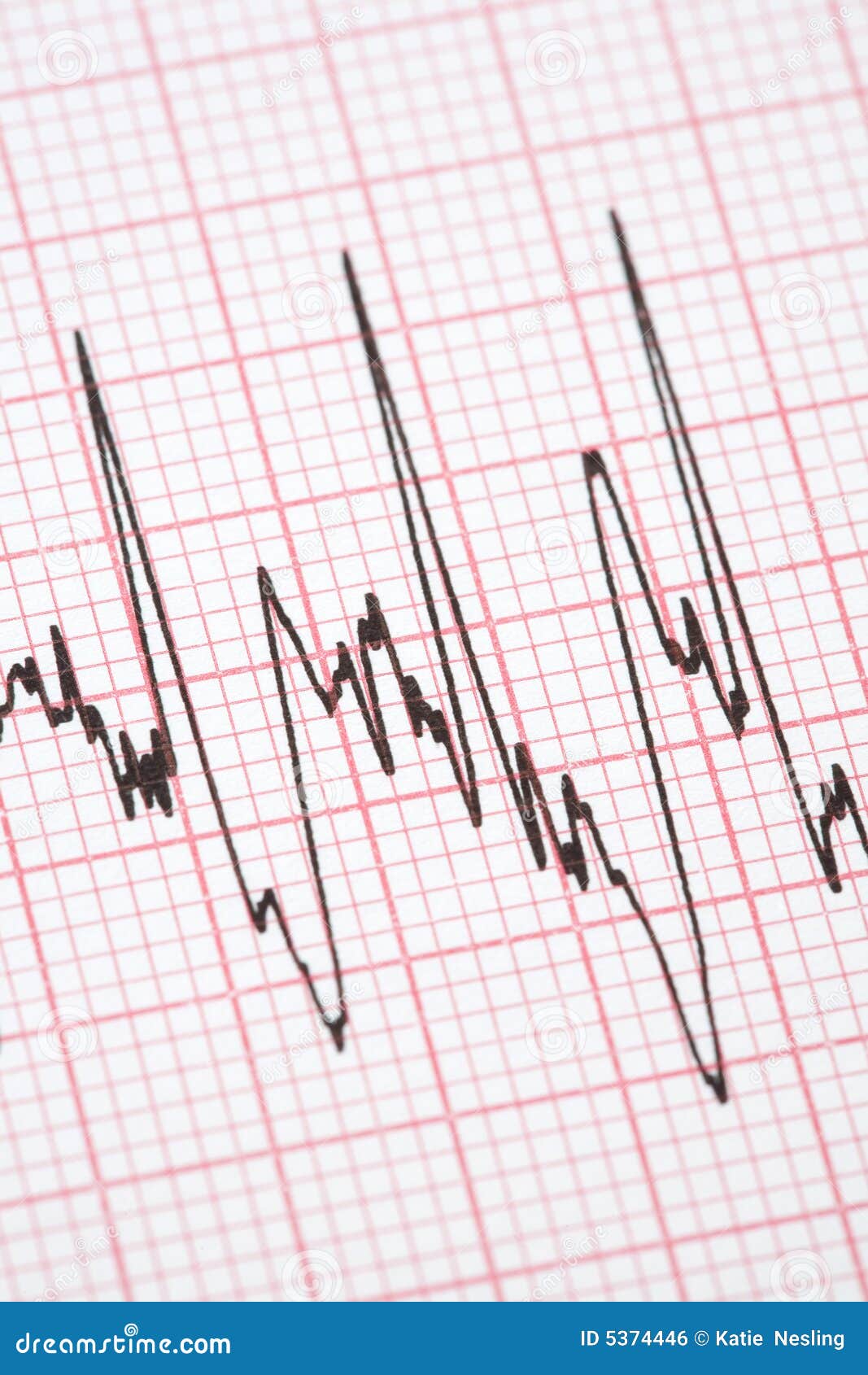 normal cardiograph normal cardiograph