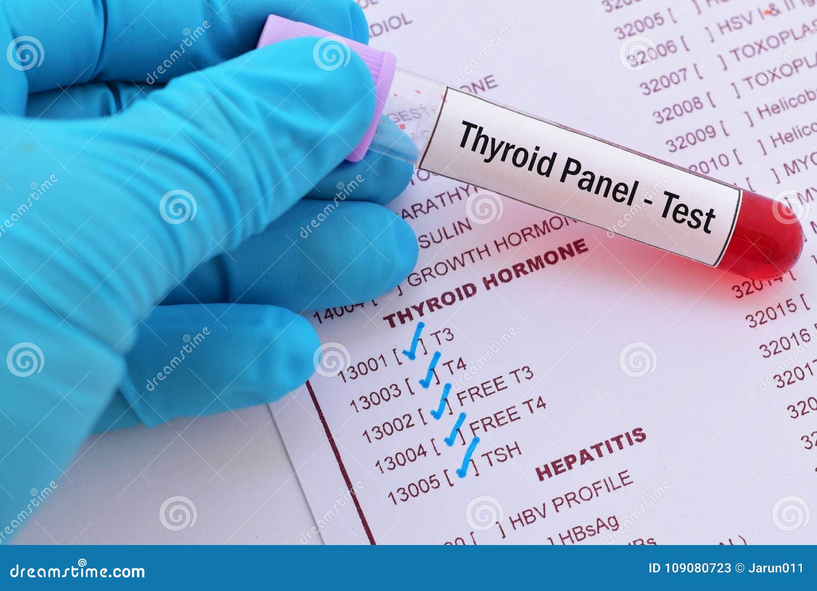 prise de sang pour l essai de panneau thyroide image stock image du hormone thyroide 109080723