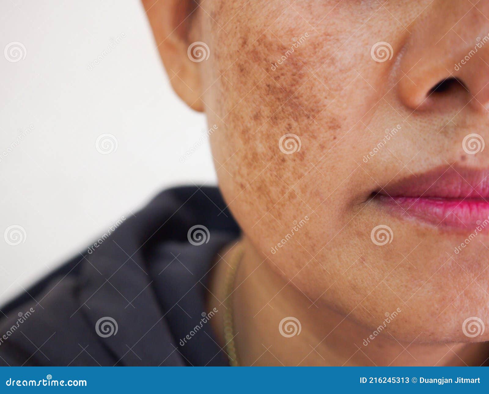 problem skincare and health concept. wrinkles, melasma, dark spots, freckles, dry skin on face middle age women.