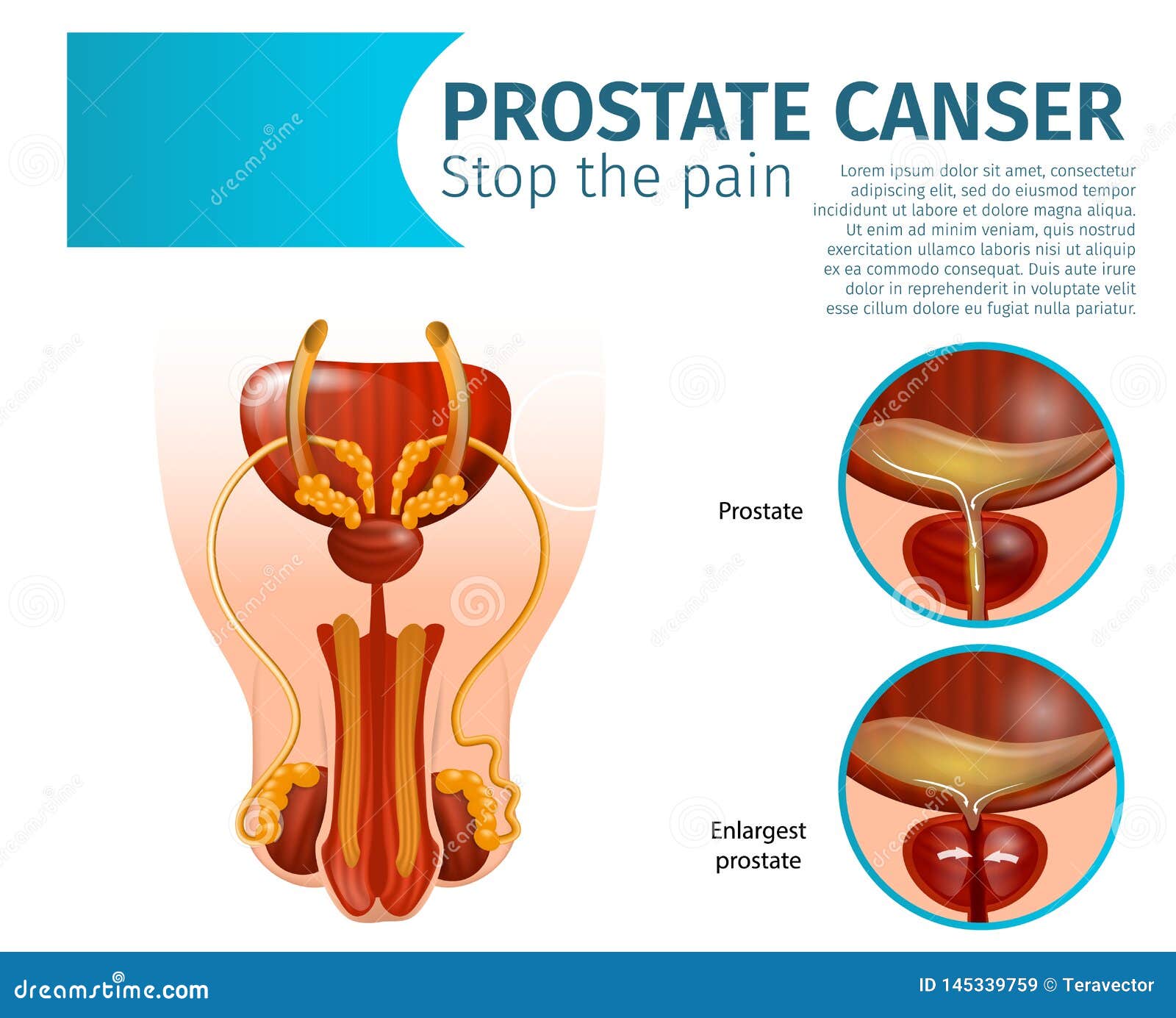 leaky gut prostatitis