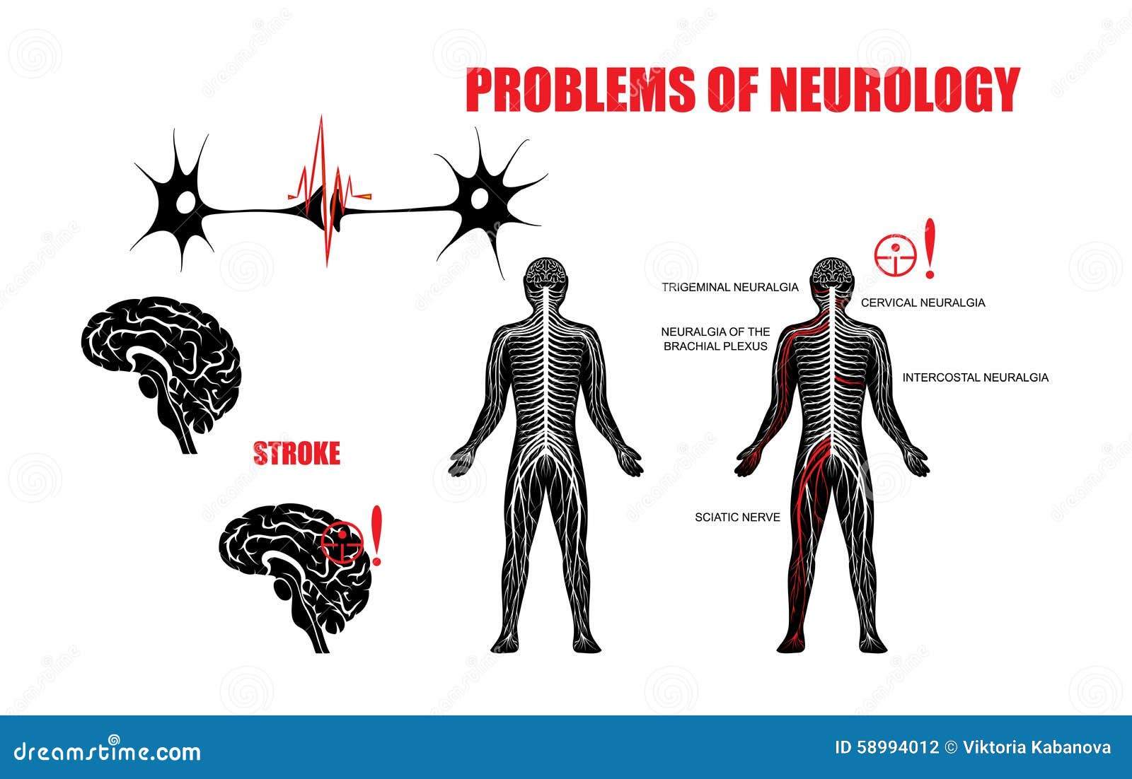 Problems Of Neurology Stock Vector Illustration Of Anatomy 58994012