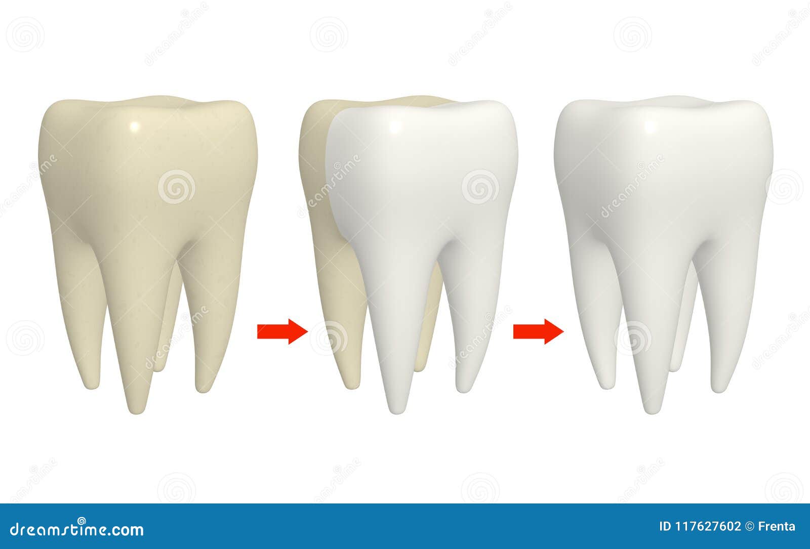 Process of cleaning teeth stock illustration. Illustration of