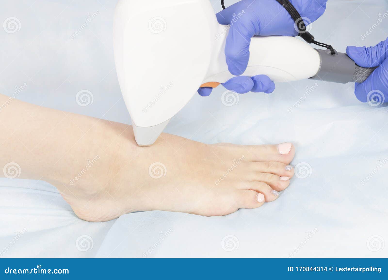 The Process of Laser Depilation of Female Limbs Stock Photo Image of