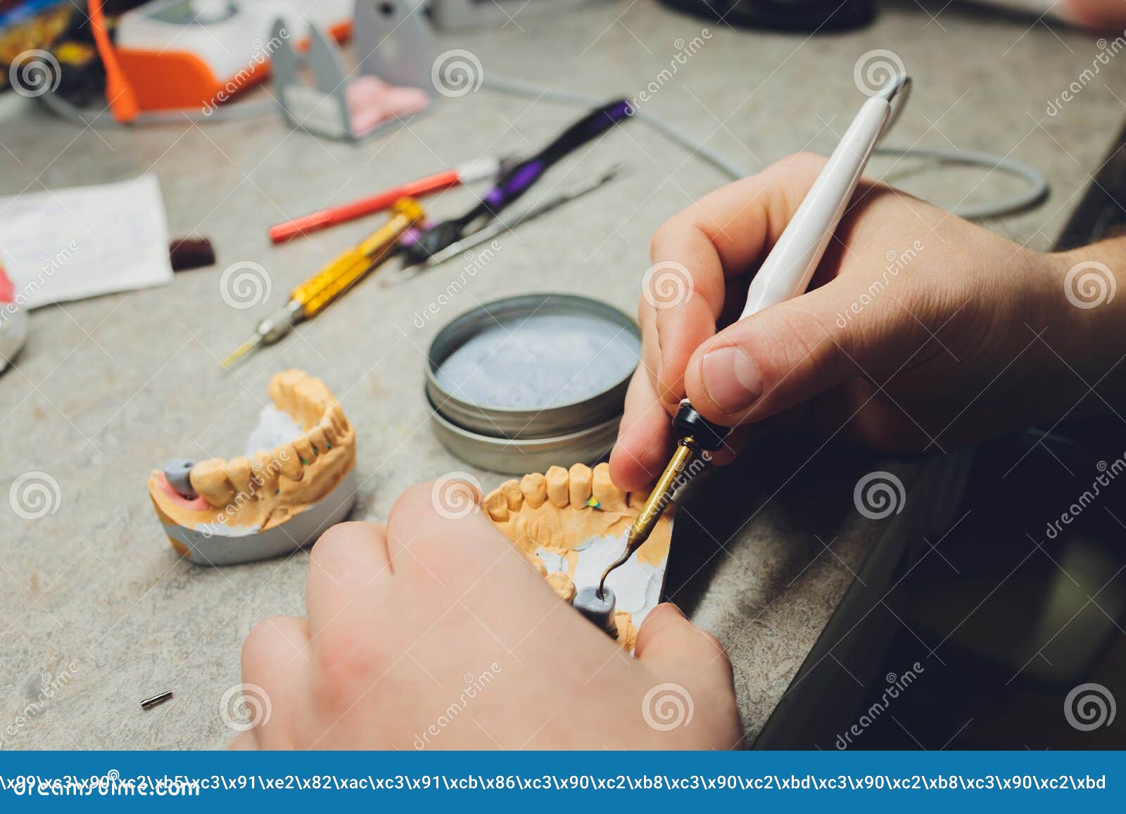 The Process of Making a Dental Prosthesis in a Dental Laboratory. Stock