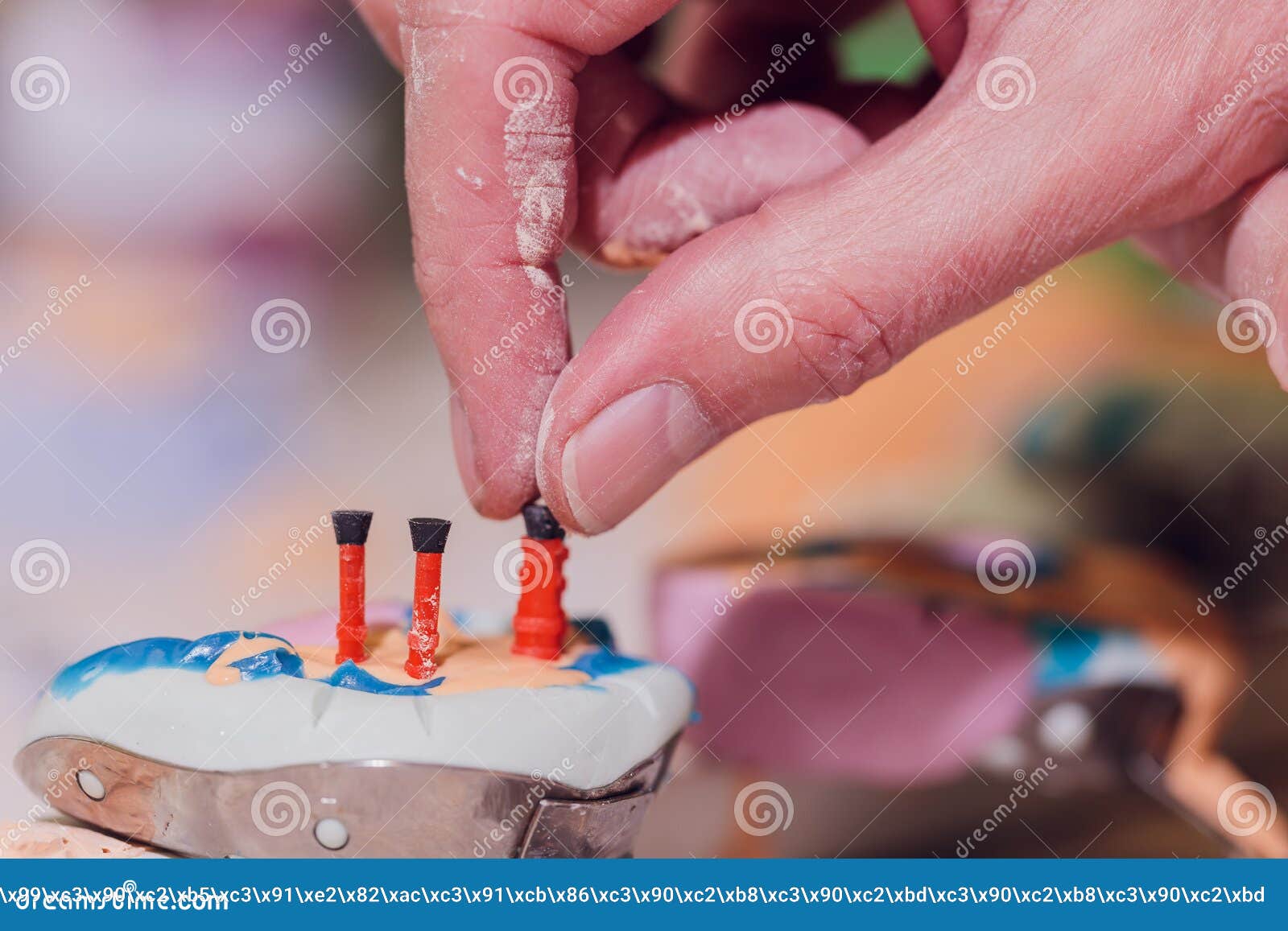 The Process of Making a Dental Prosthesis in a Dental Laboratory. Stock