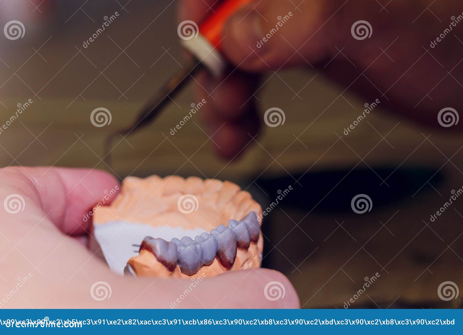 The Process of Making a Dental Prosthesis in a Dental Laboratory. Stock