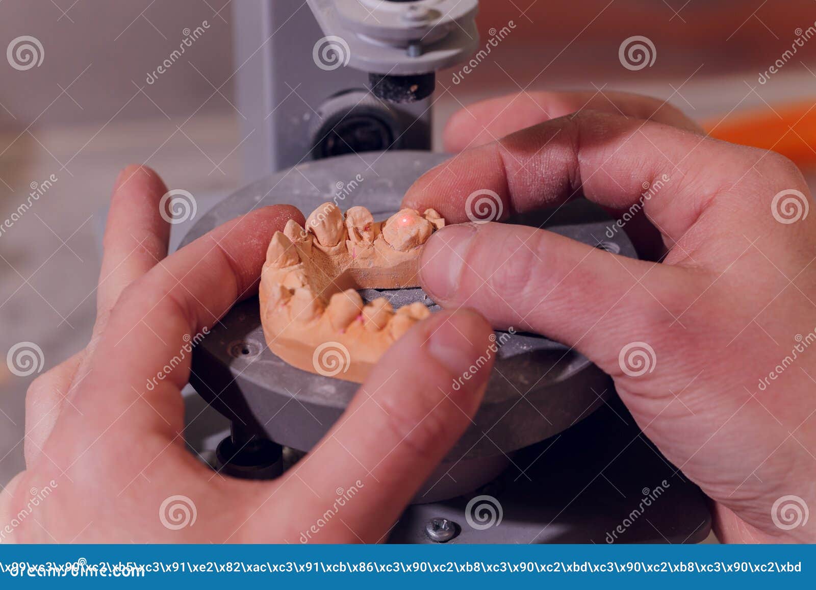 The Process of Making a Dental Prosthesis in a Dental Laboratory. Stock