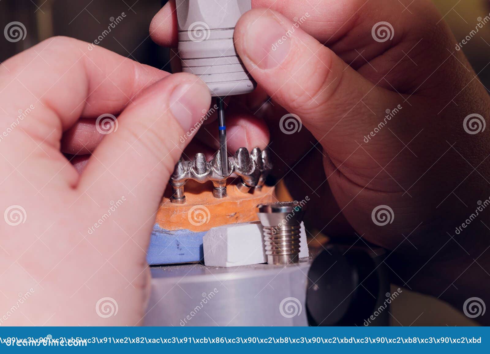 The Process of Making a Dental Prosthesis in a Dental Laboratory. Stock