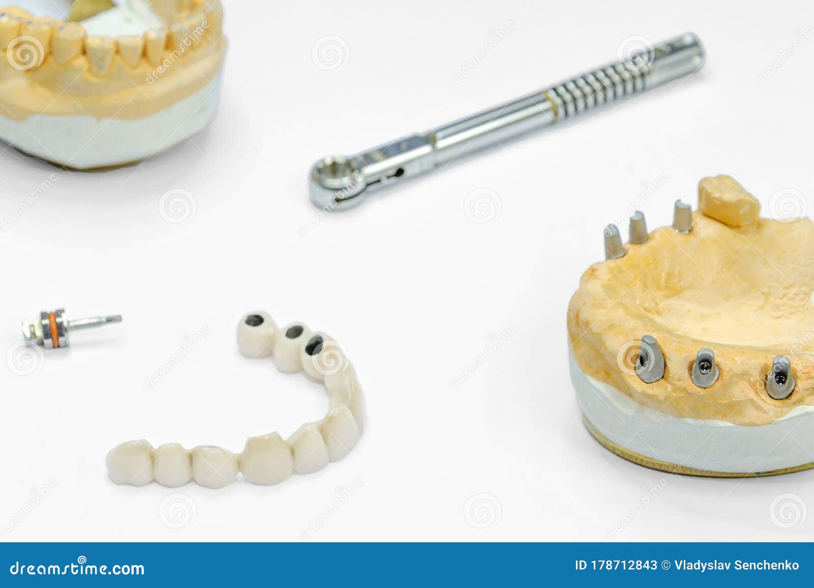 The Process of Manufacturing Ceramic Teeth on Implants. Dental Implants