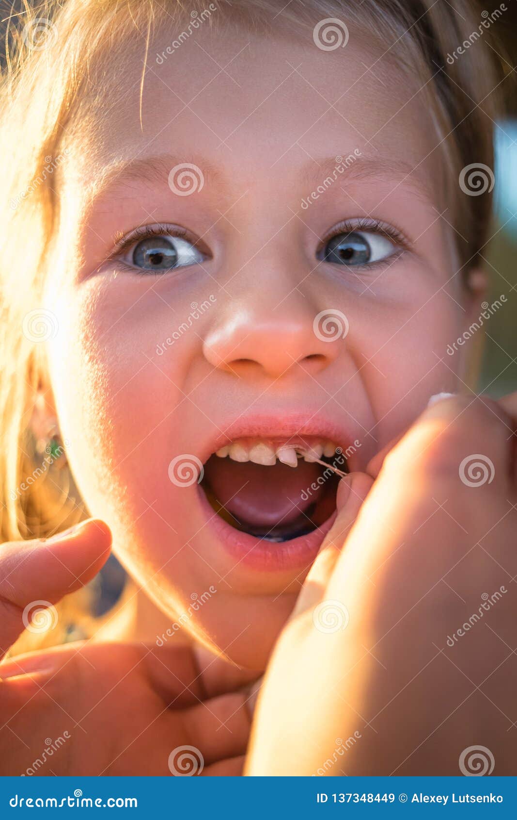 The Process of Removing a Baby Tooth Using a Thread Stock Image Image