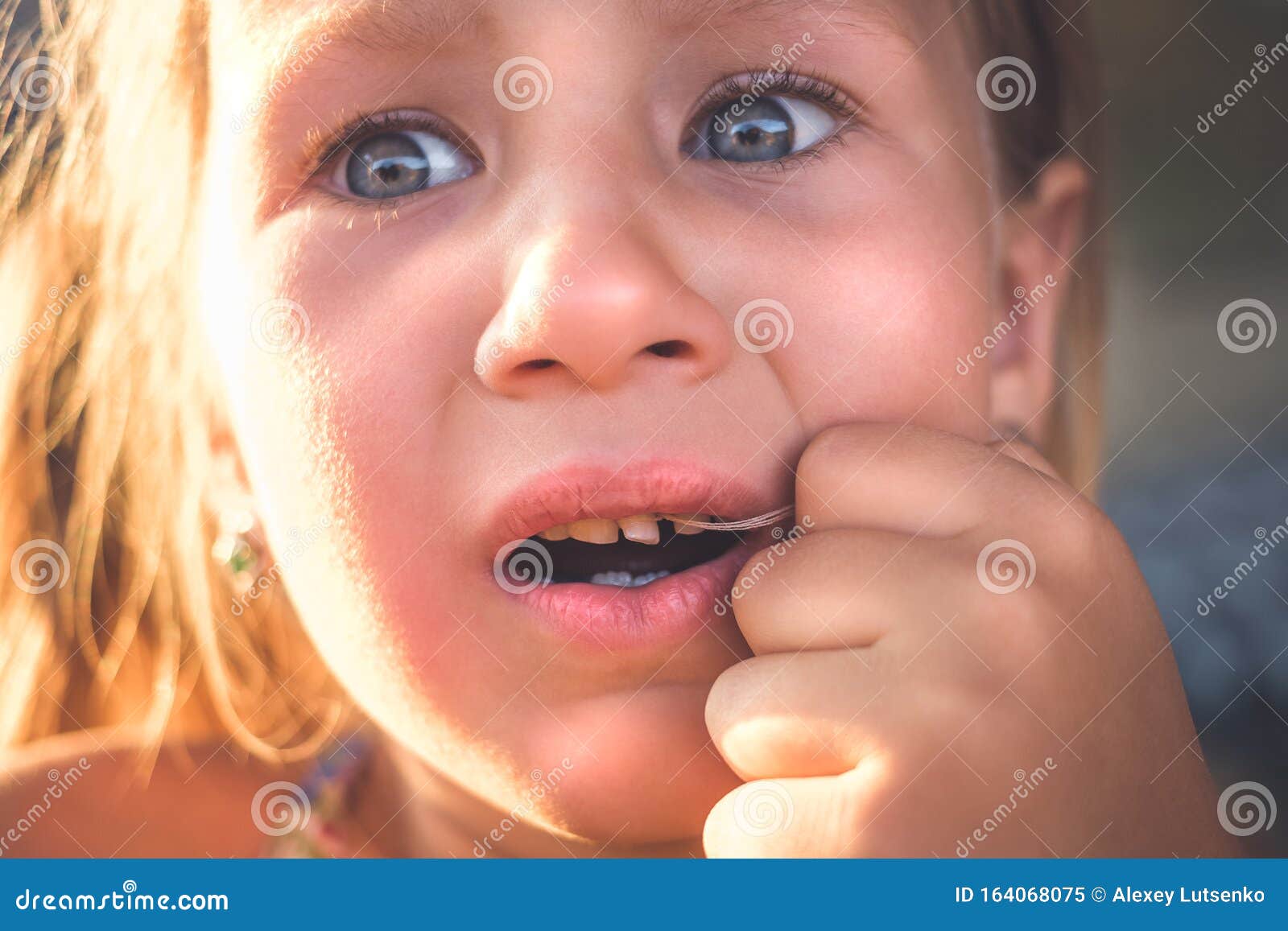 The Process of Removing a Baby Tooth Using a Thread Stock Image Image
