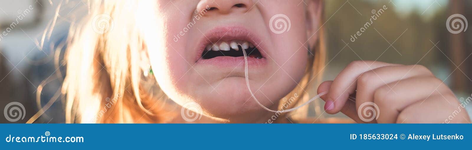 The Process of Removing a Baby Tooth Using a Thread Stock Photo Image