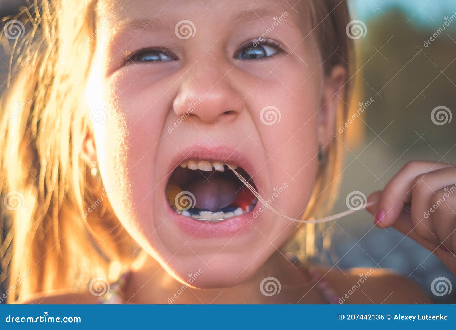 The Process of Removing a Baby Tooth Using a Thread Stock Photo Image
