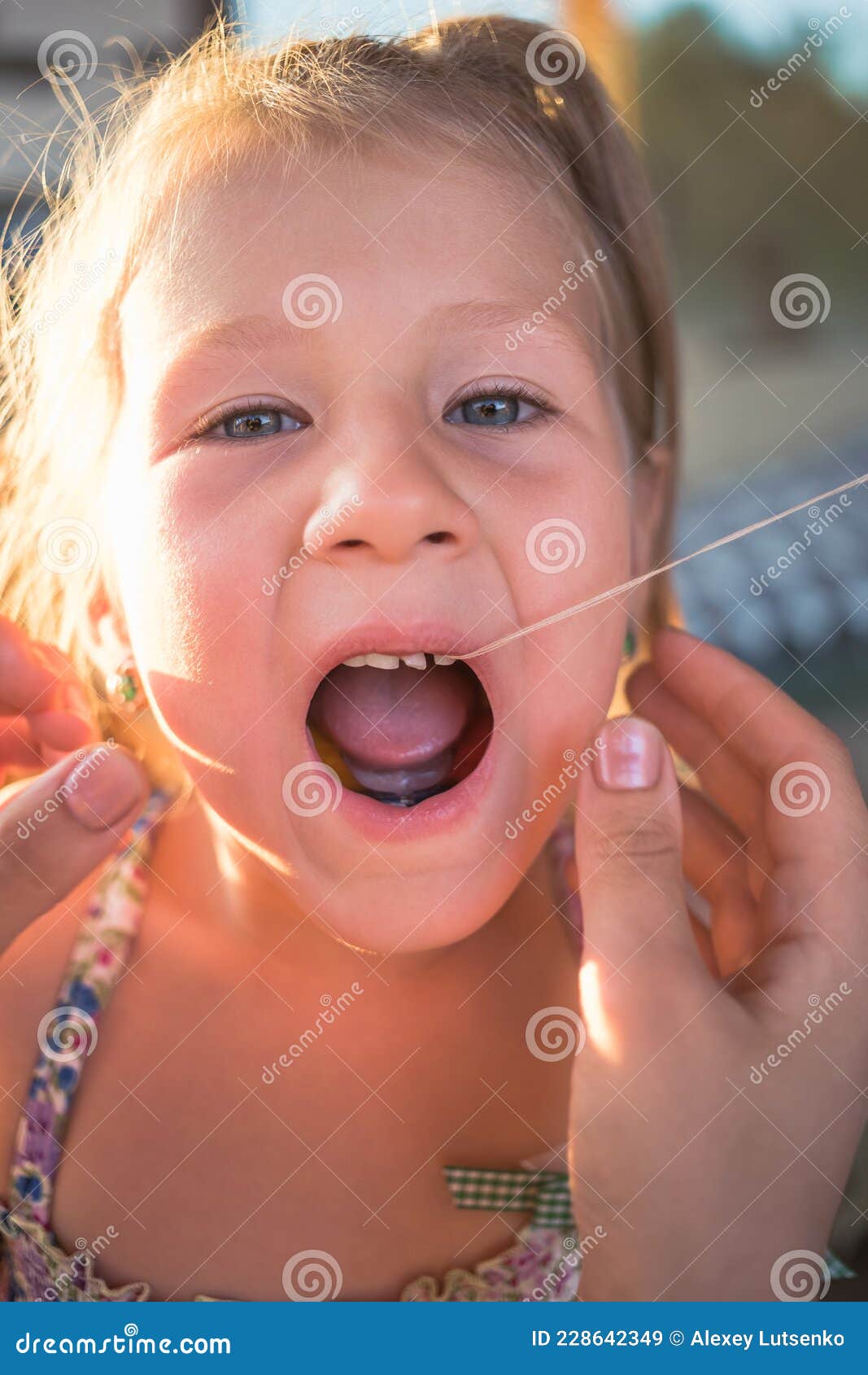 The Process of Removing a Baby Tooth Using a Thread Stock Image Image