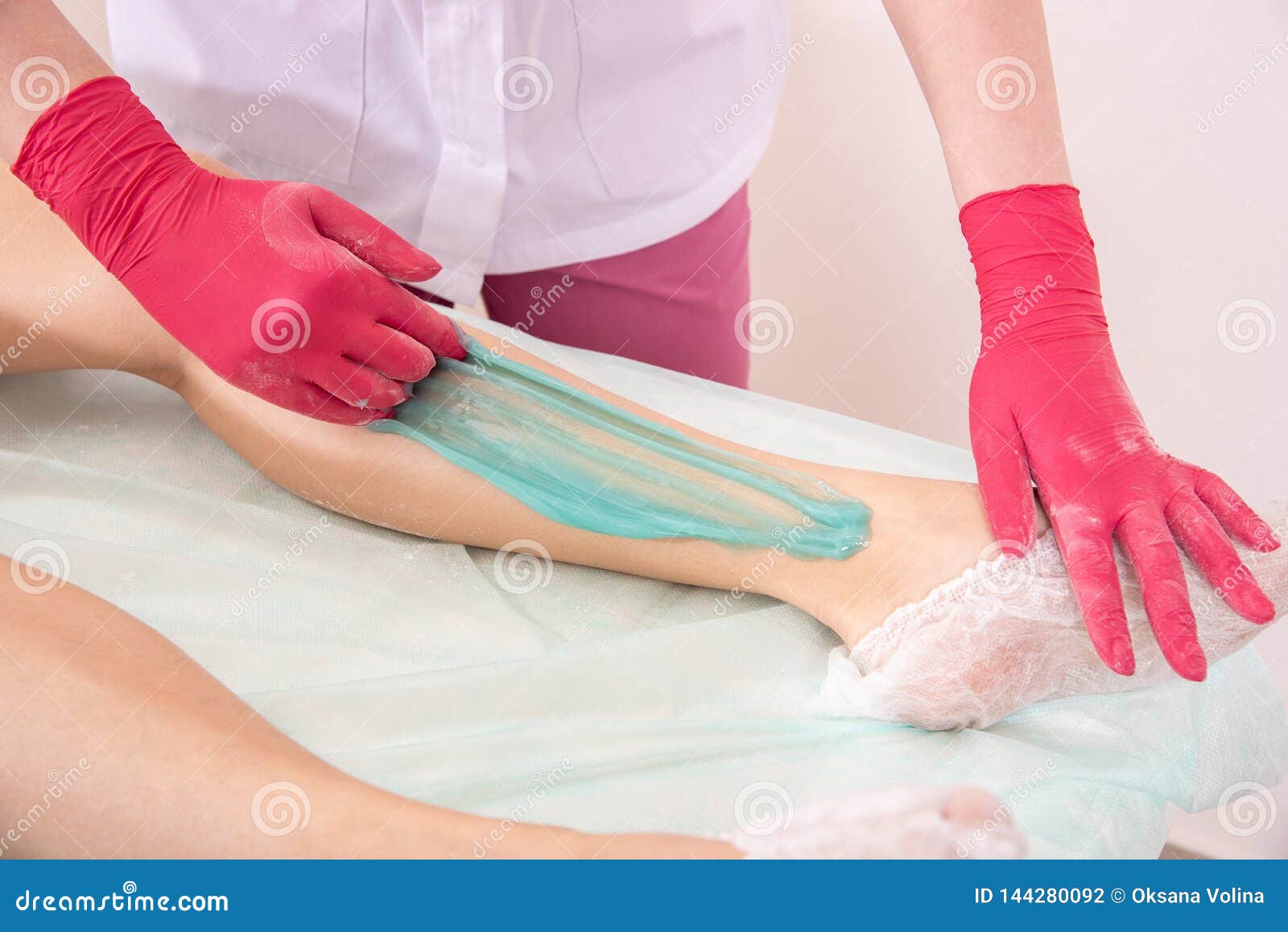 The Process of Sugar Depilation. Master in Medical Gloves Puts a Blue