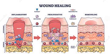 Process of Wound Healing and Anatomical Body Injury Repair Outline Biology Diagrams