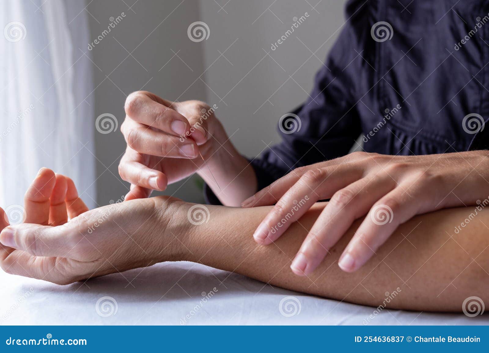 profesional woman giving acupuncture treatment