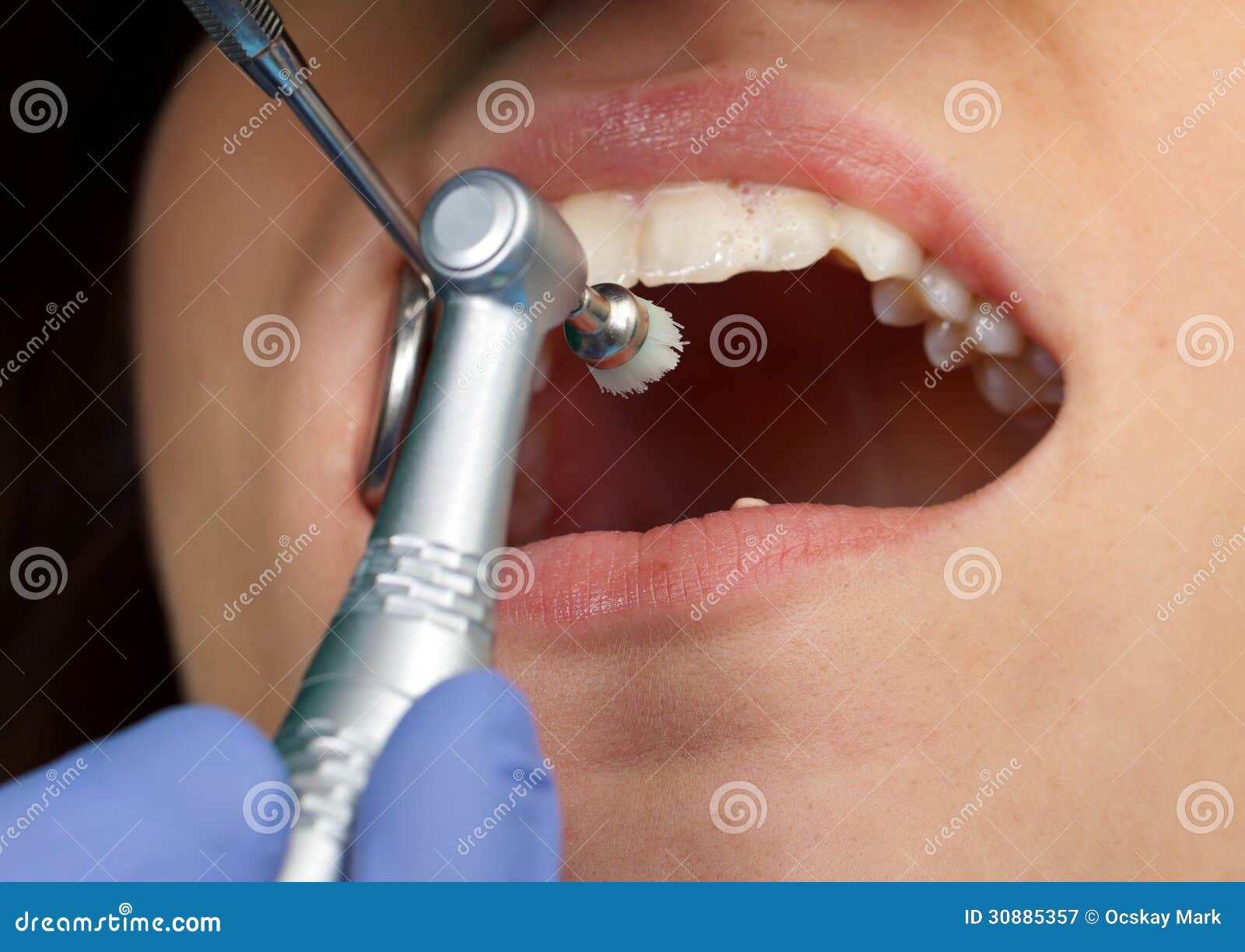 Professional Dental Brushing Stock Image Image of doctor, adult 30885357