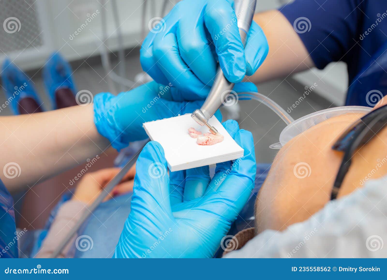 Professional Teeth Cleaning, Using a Special Paste and Brush Stock