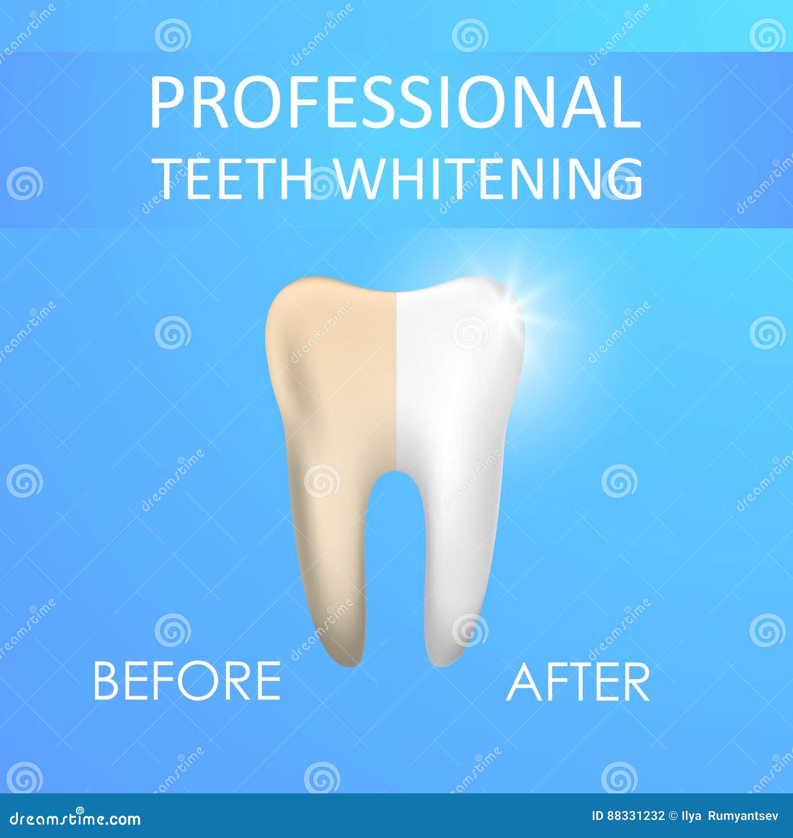 Professional Teeth Whitening, Healthy and Yellow Tooth Stock Vector