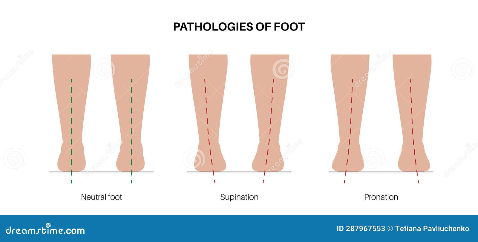 Arm supination and pronation vector illustration. Labeled