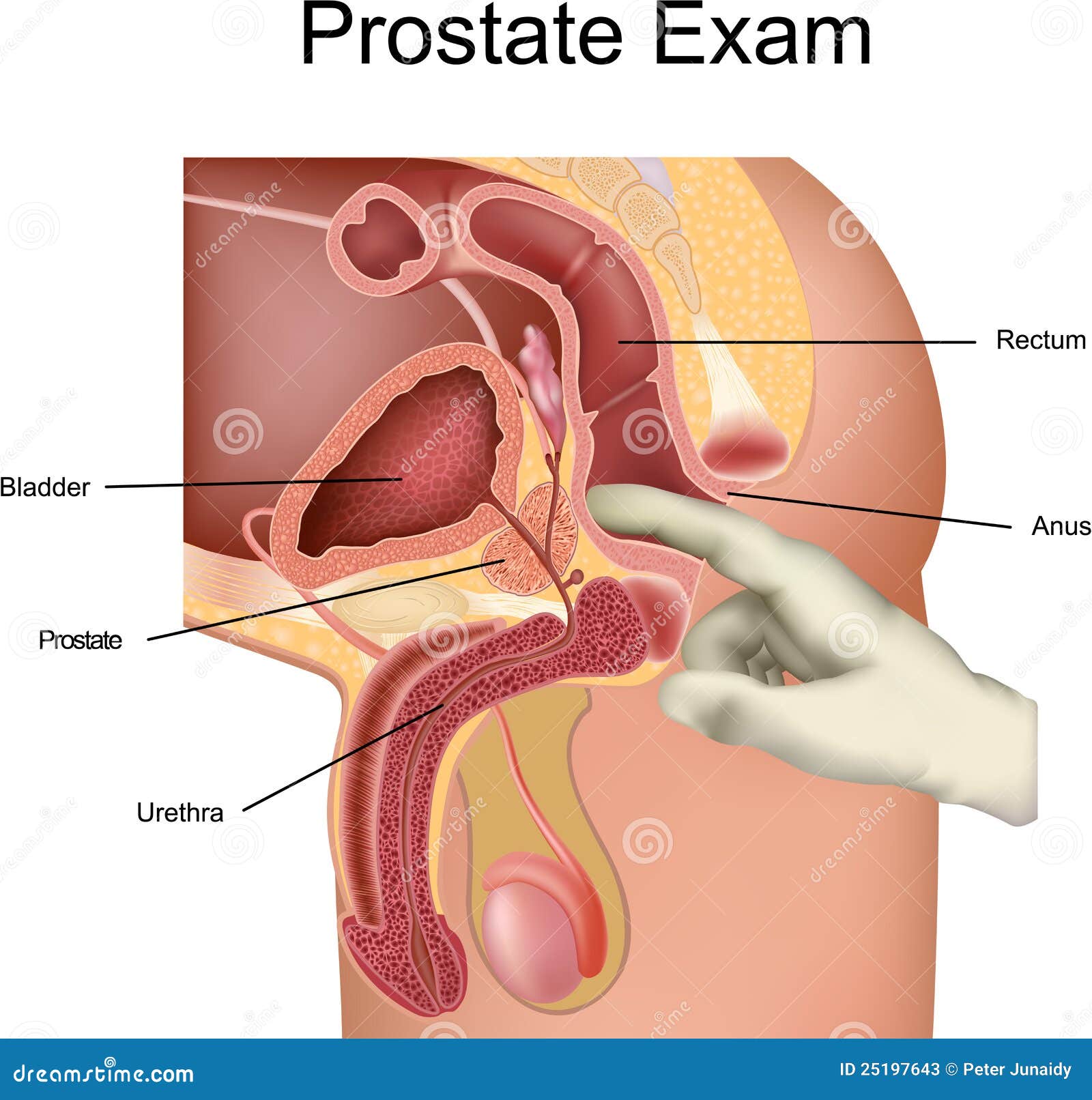 Prostate Exam stock vector. Illustration of exam, medical - 25197643