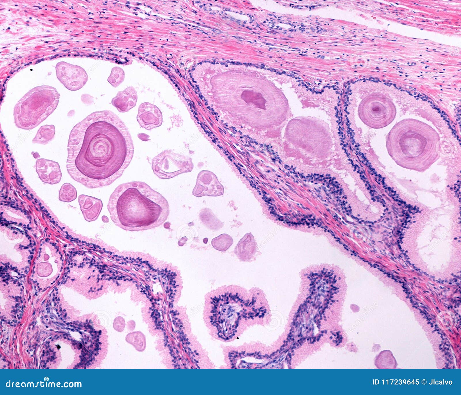 a prostatitis tarascul kezelése