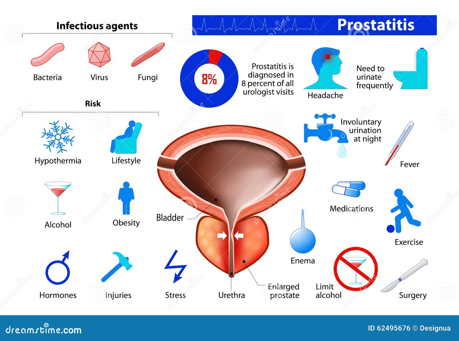 Prostatitis és alkohol, Nonbacterial prostatitis caused by stress