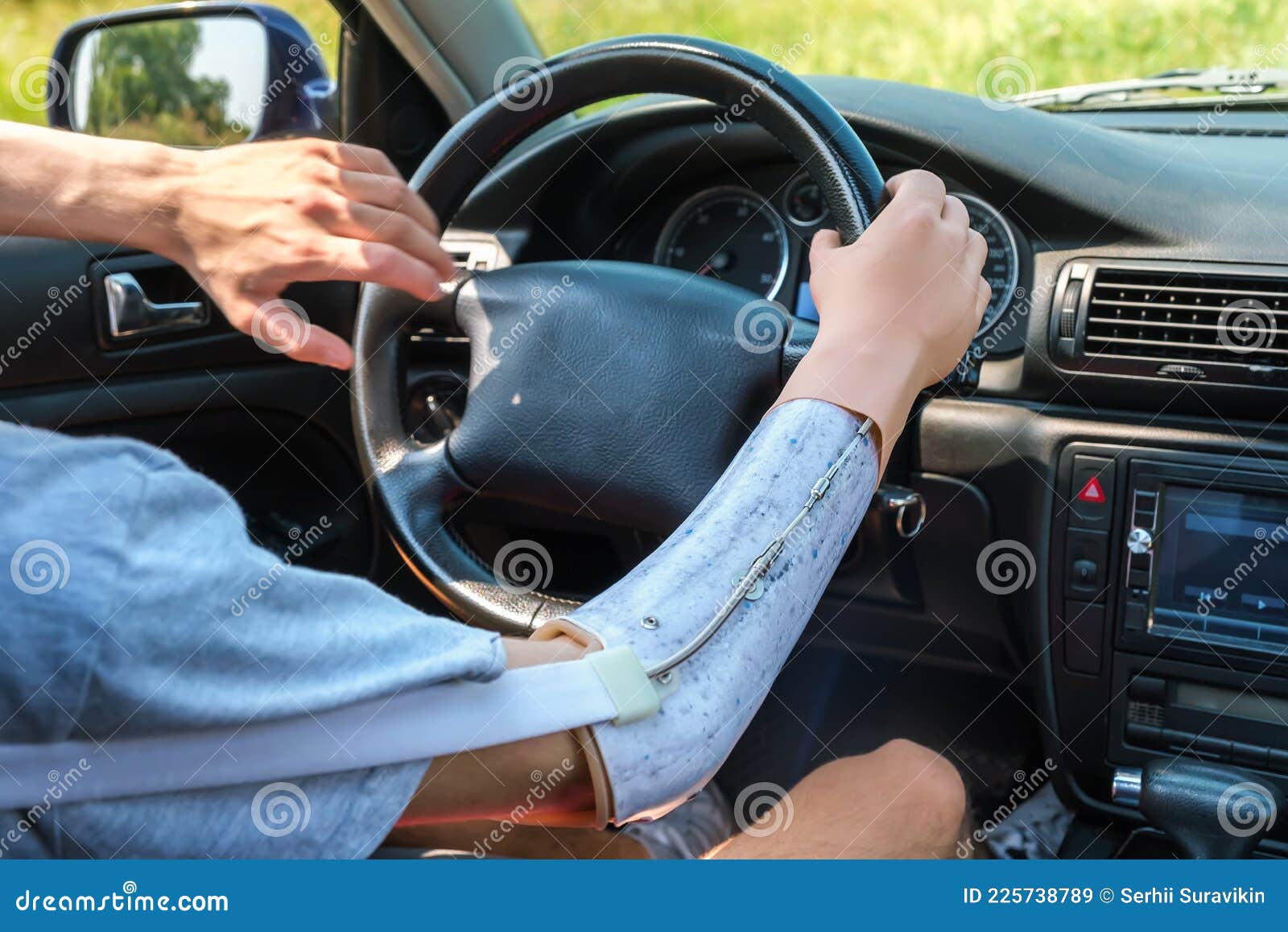 https://thumbs.dreamstime.com/z/prothetische-amputierte-hand-von-kaukasischen-mann-auf-dem-lenkrad-die-auto-f%C3%A4hrt-prothetisch-eines-mannes-der-ein-einem-225738789.jpg