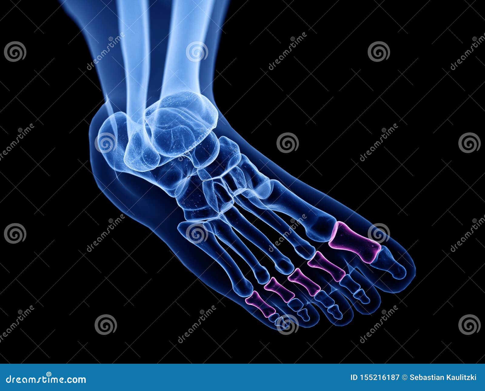 the proximal phalanx bones