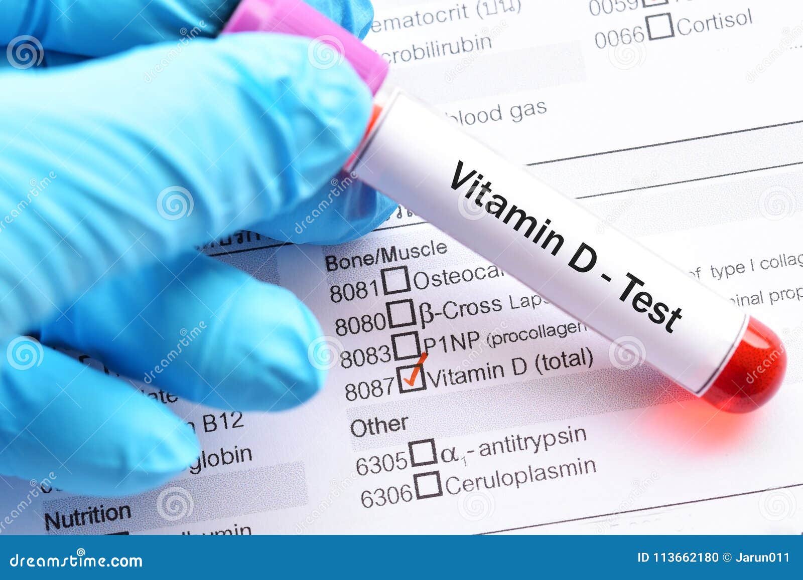 Prueba de la vitamina D foto de archivo. Imagen de examen 113662180