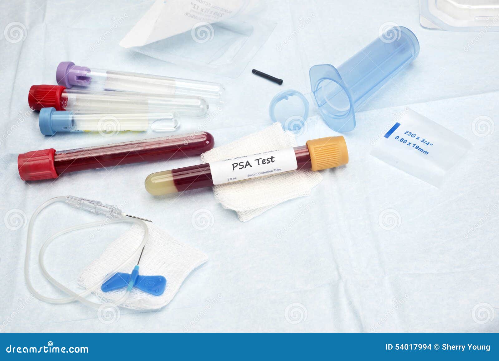 What is a PSA test?