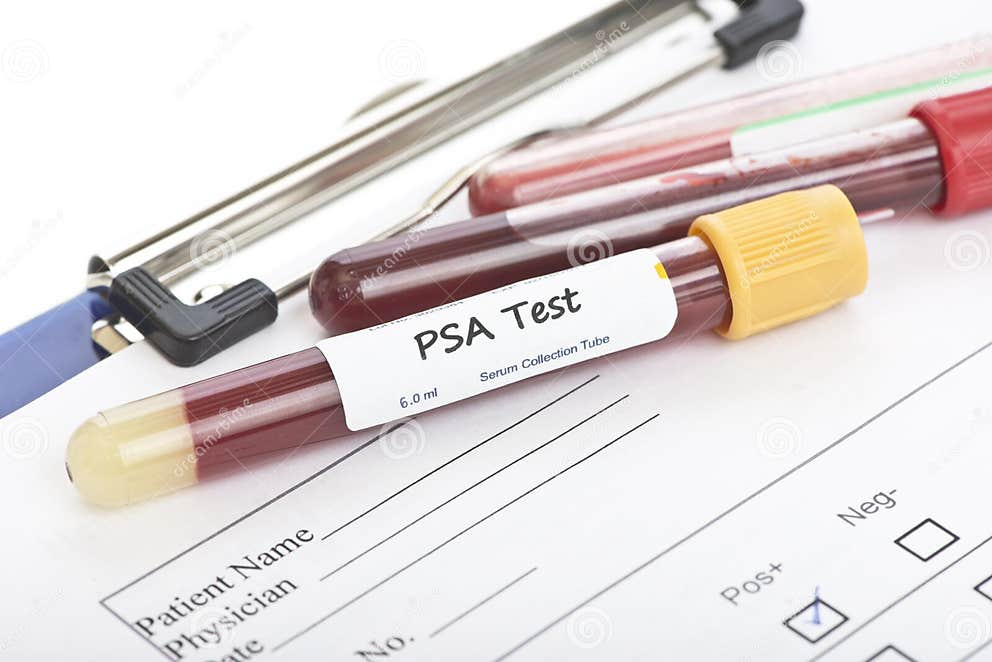 PSA Test stock photo. Image of bottle, cell, health, biotechnology ...