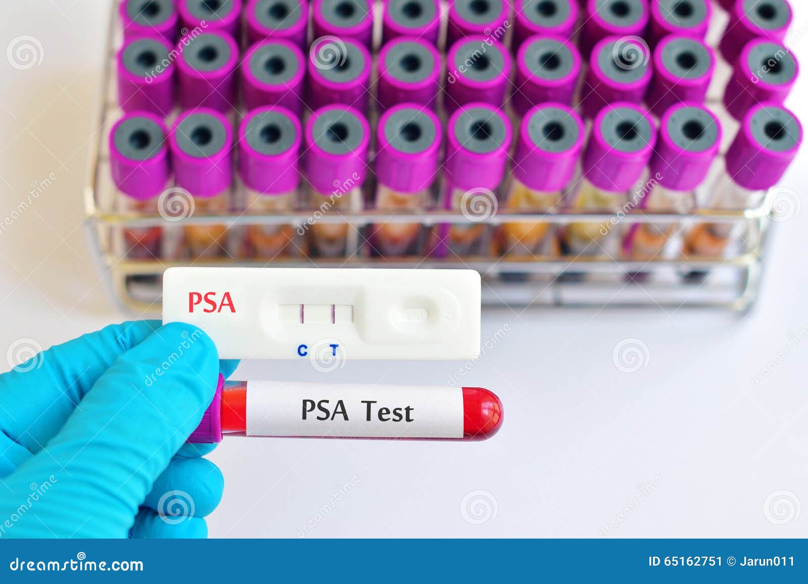 PSA testing stock image. Image of disease, serology, patient 65162751