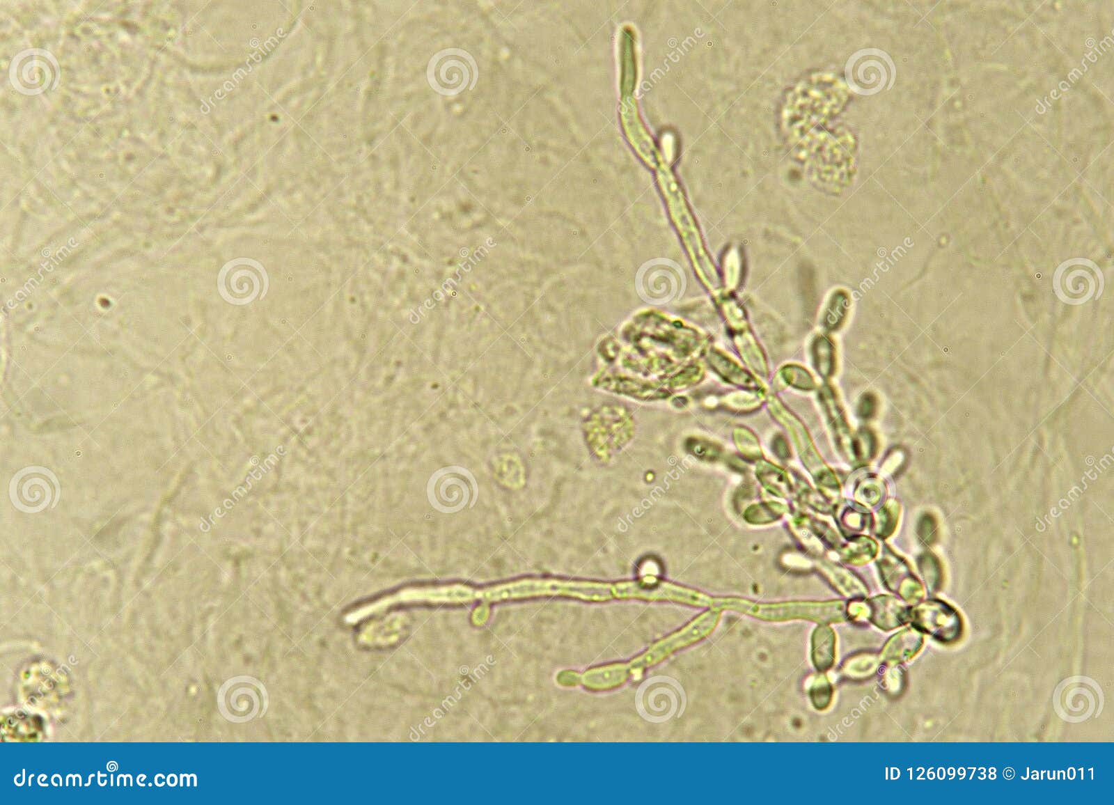Yeast Urine