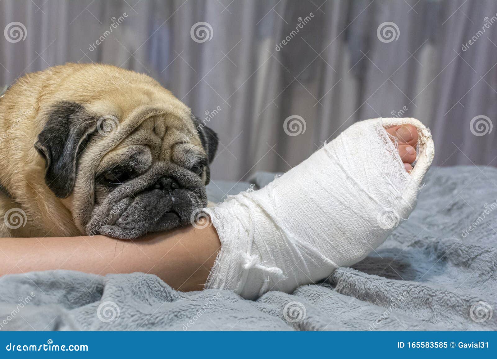 the pug laid his head on the ownerÃ¢â¬â¢s foot. human foot in a cast. the dog shows pity and compassion