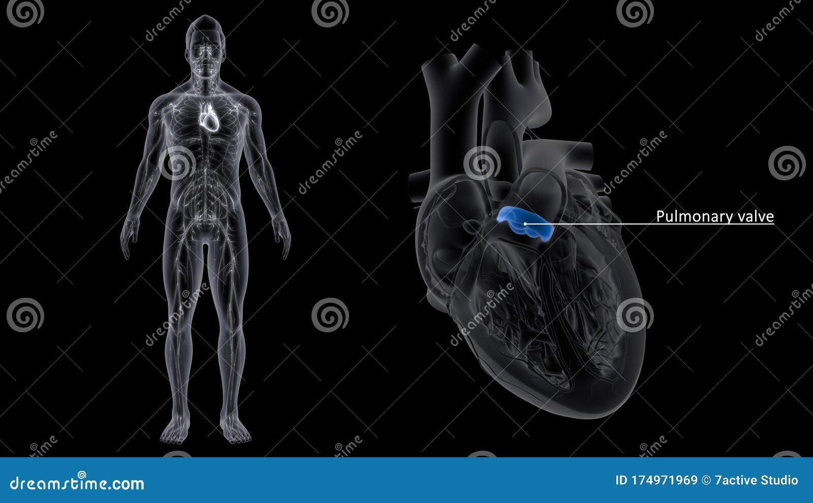 pulmonary valve of the heart