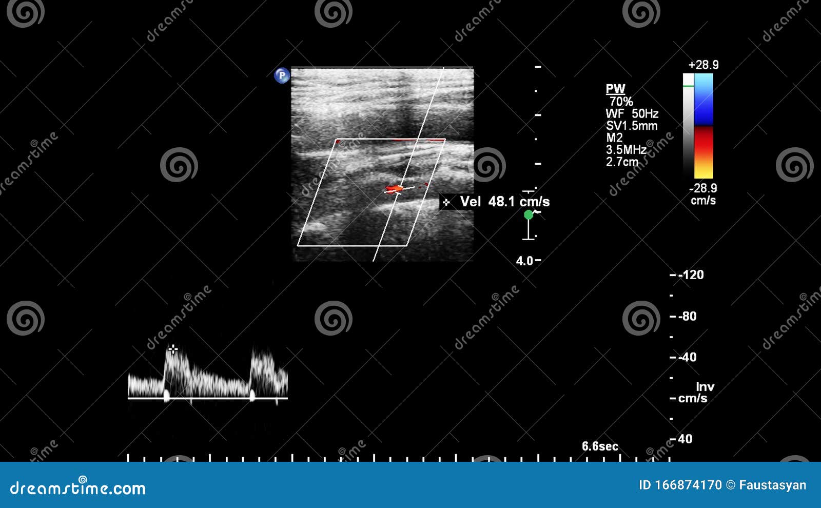 Pulse Wave Doppler Ultrasound Examination. Stock Photo Image of patient, cardiology 166874170