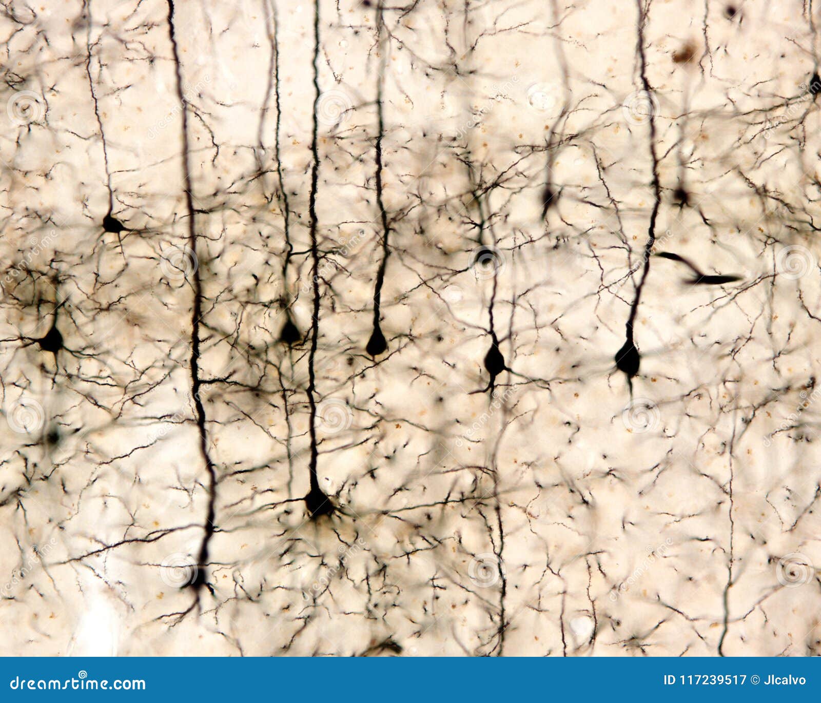 pyramidal neurons. cerebral cortex