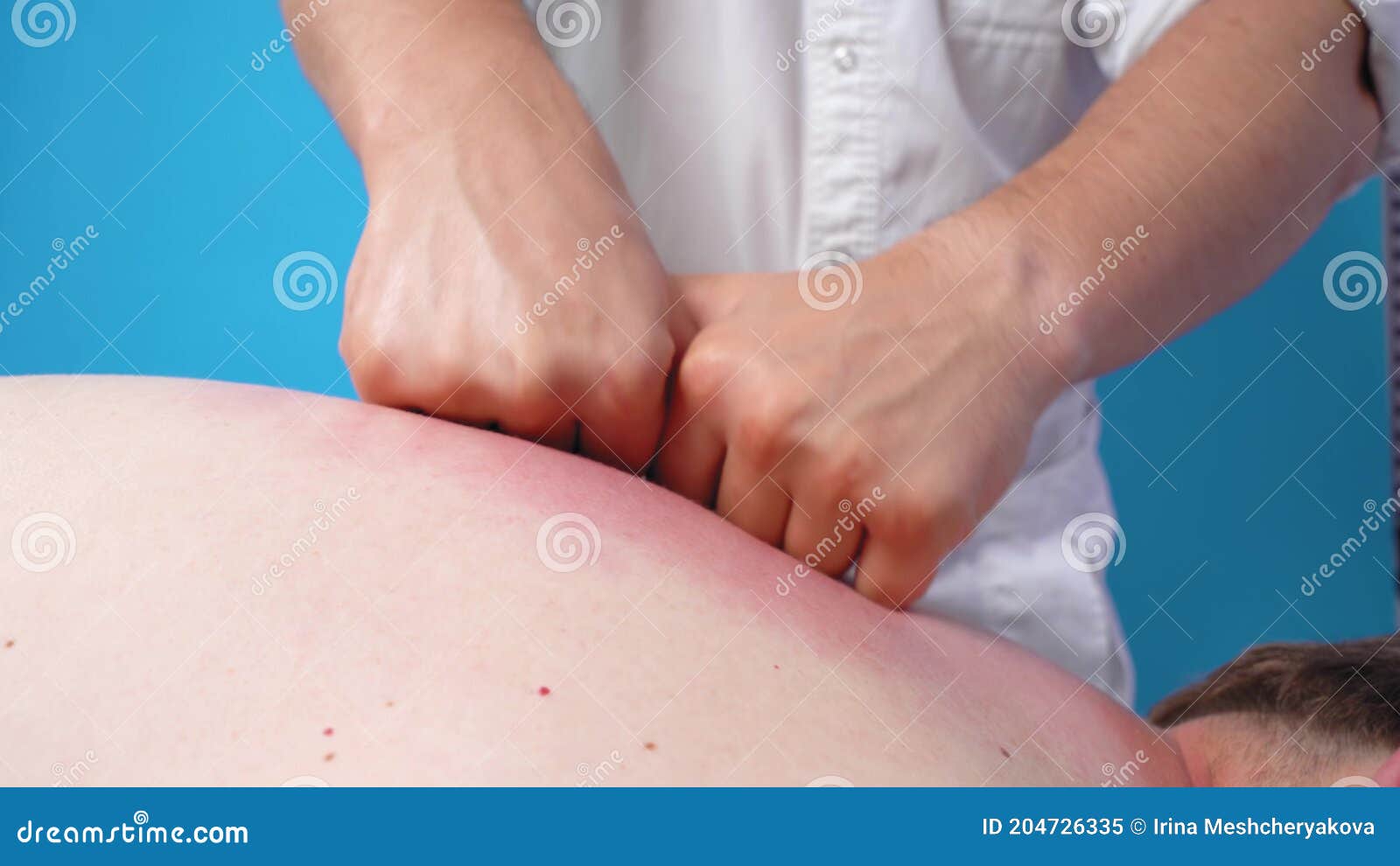 https://thumbs.dreamstime.com/z/quiropr%C3%A1ctico-profesional-masajes-intensivos-y-amasas-cansados-dolores-musculares-de-espalda-cuello-paciente-cerca-terapia-salud-204726335.jpg