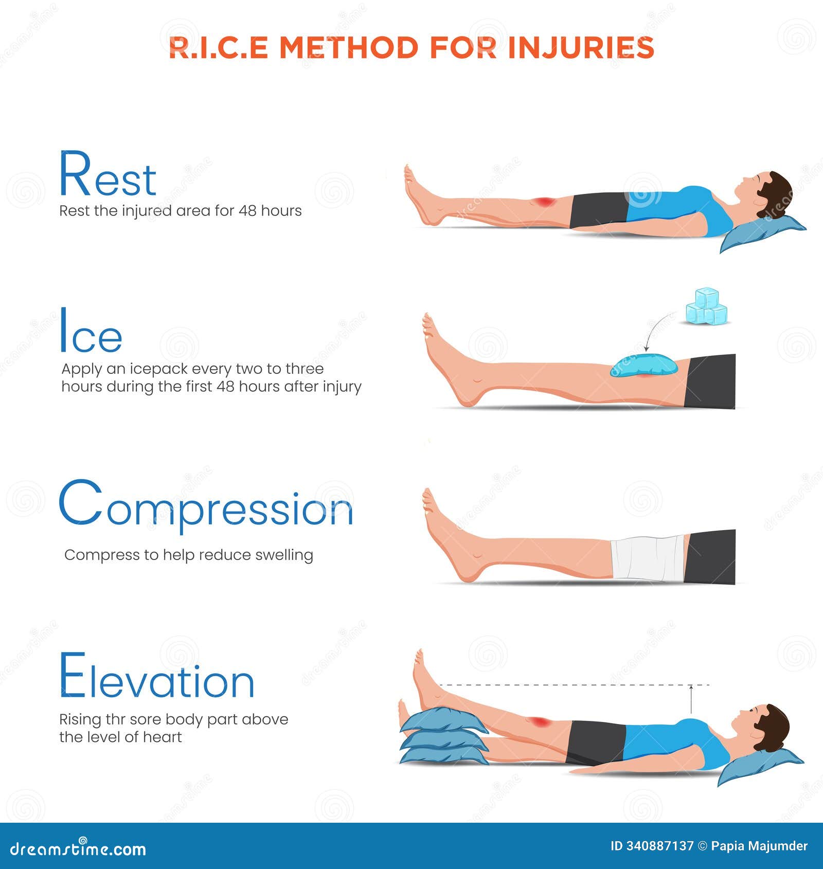 r.i.c.e method for injuries rest, ice, compression, and elevation for quick recovery