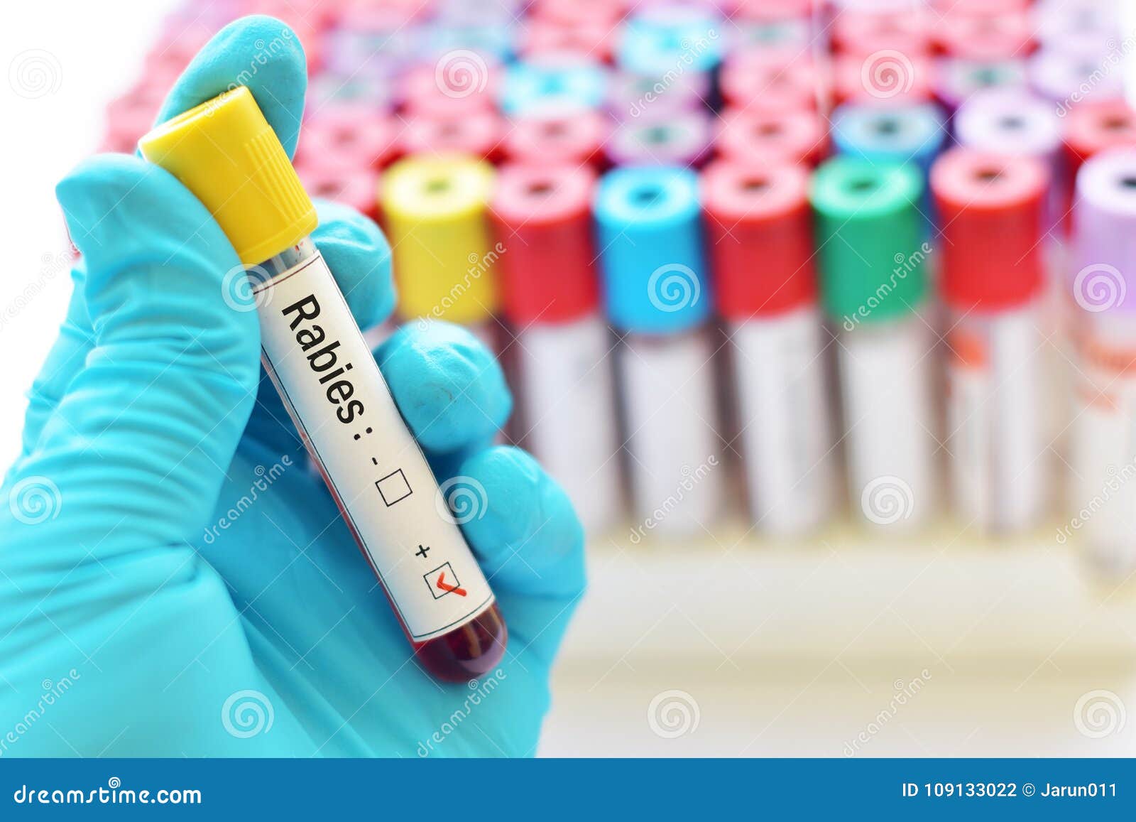 rabies virus