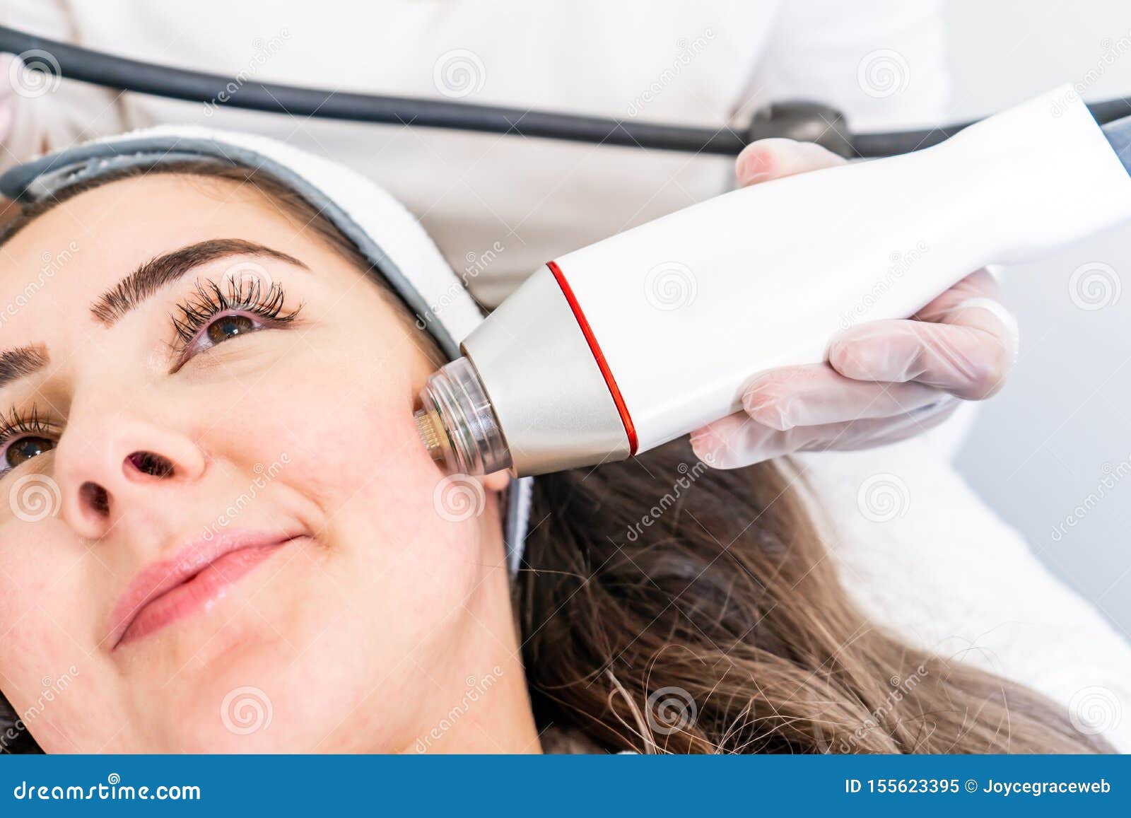 radio frequency microneedling machine handpiece on the cheek of a woman`s face during a beauty skin tightening treatment