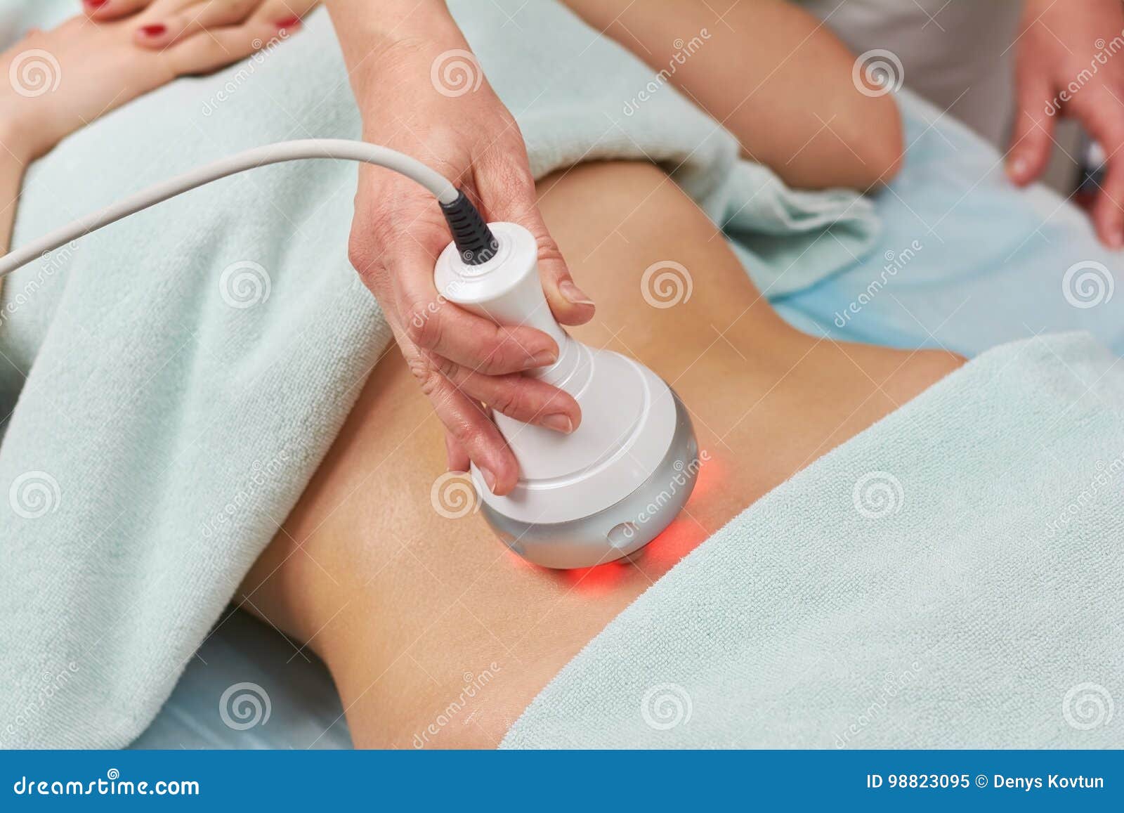 radio frequency skin tightening machine.