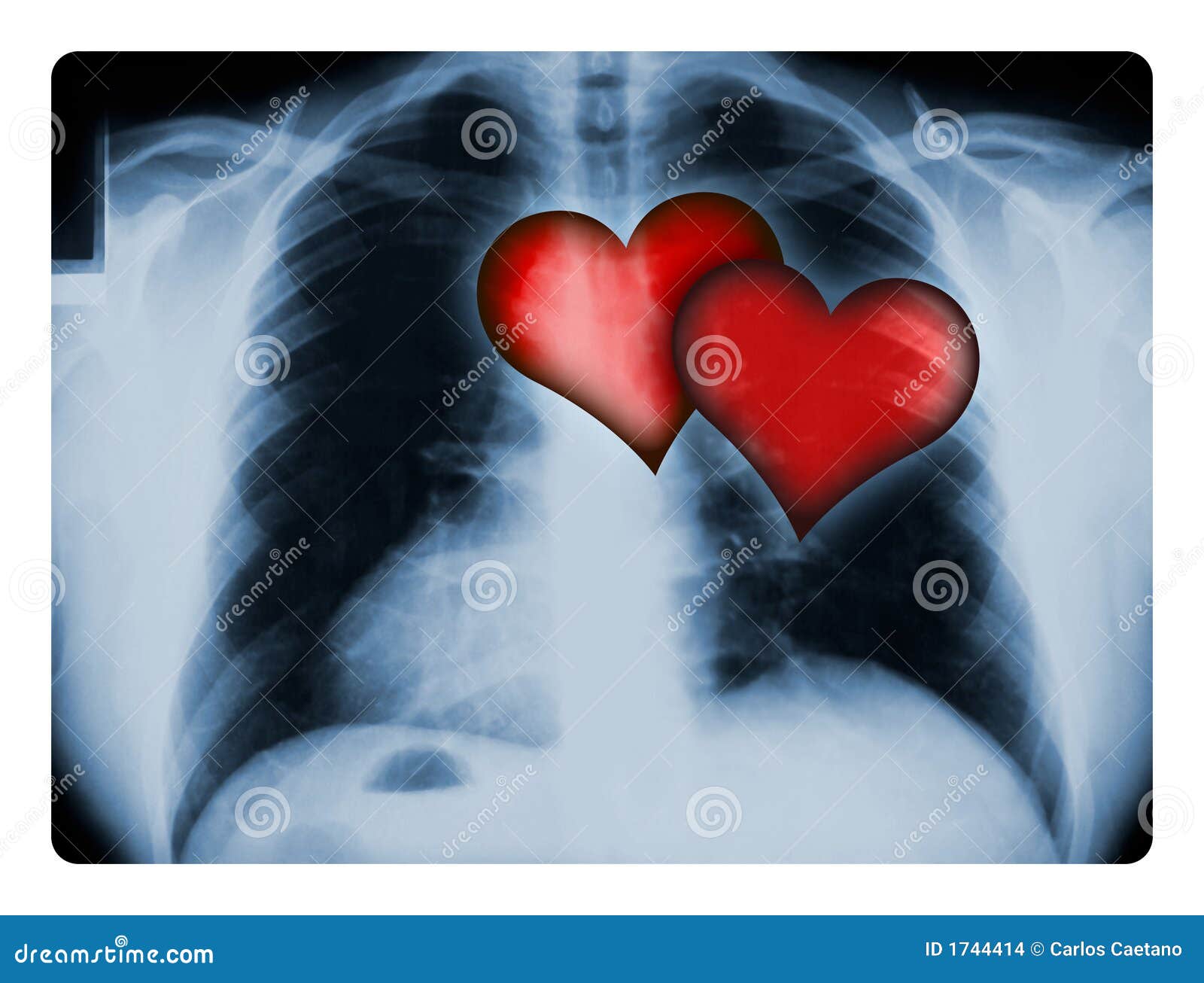 Image result for 2 corazones en el pecho