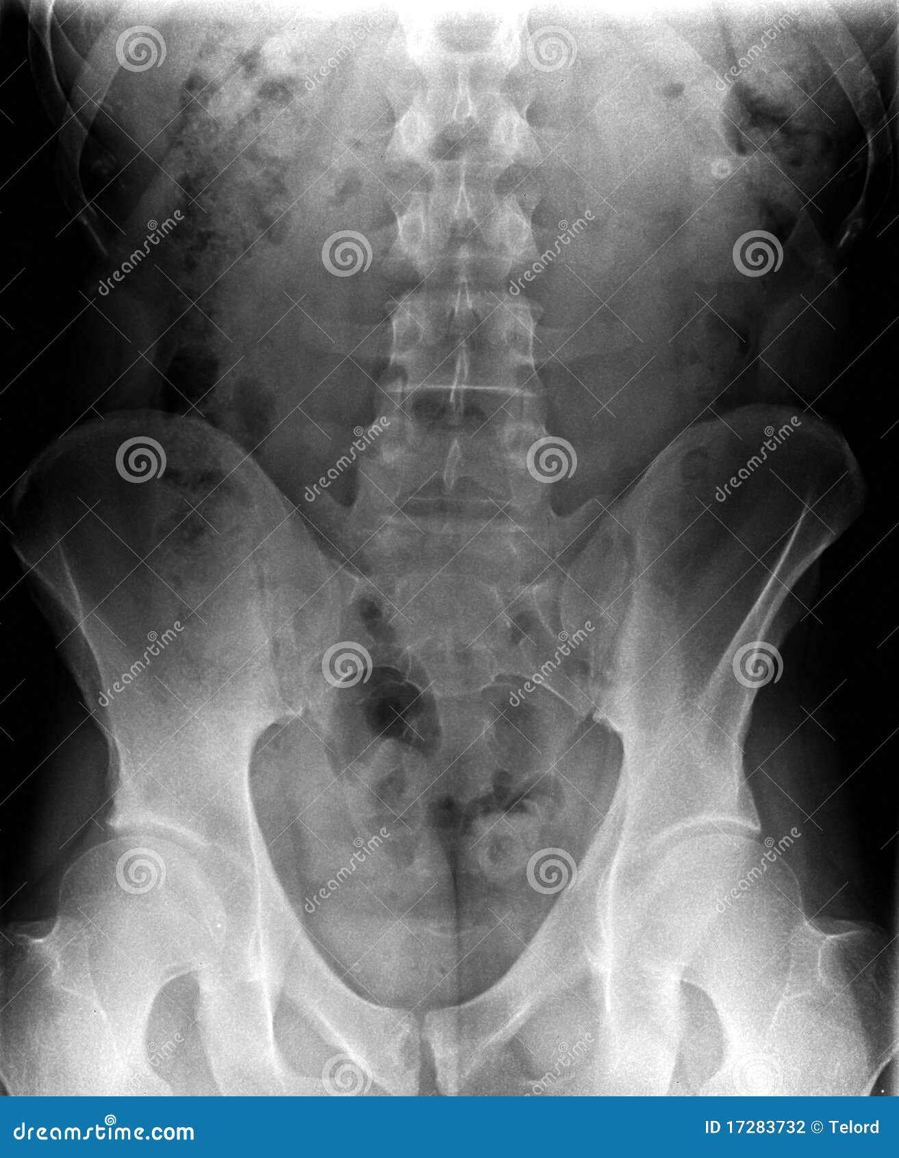 radiography, x-ray of a vertebral column