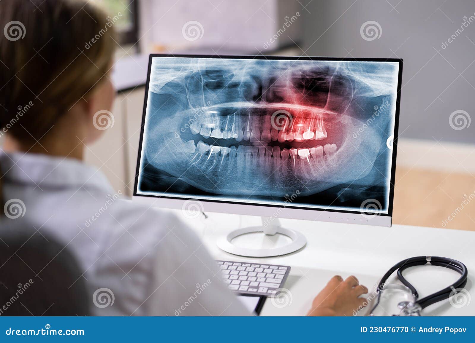 Radiologist Dentist Using X Ray Software Stock Photo Image of